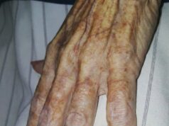 Ze koos roze nagels als laatste wens – de reden bezorgt kippenvel