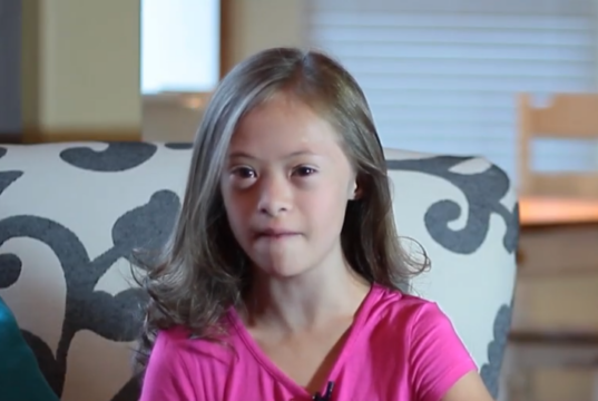 Artsen raadden opname aan, nu schittert dit meisje met downsyndroom als topmodel